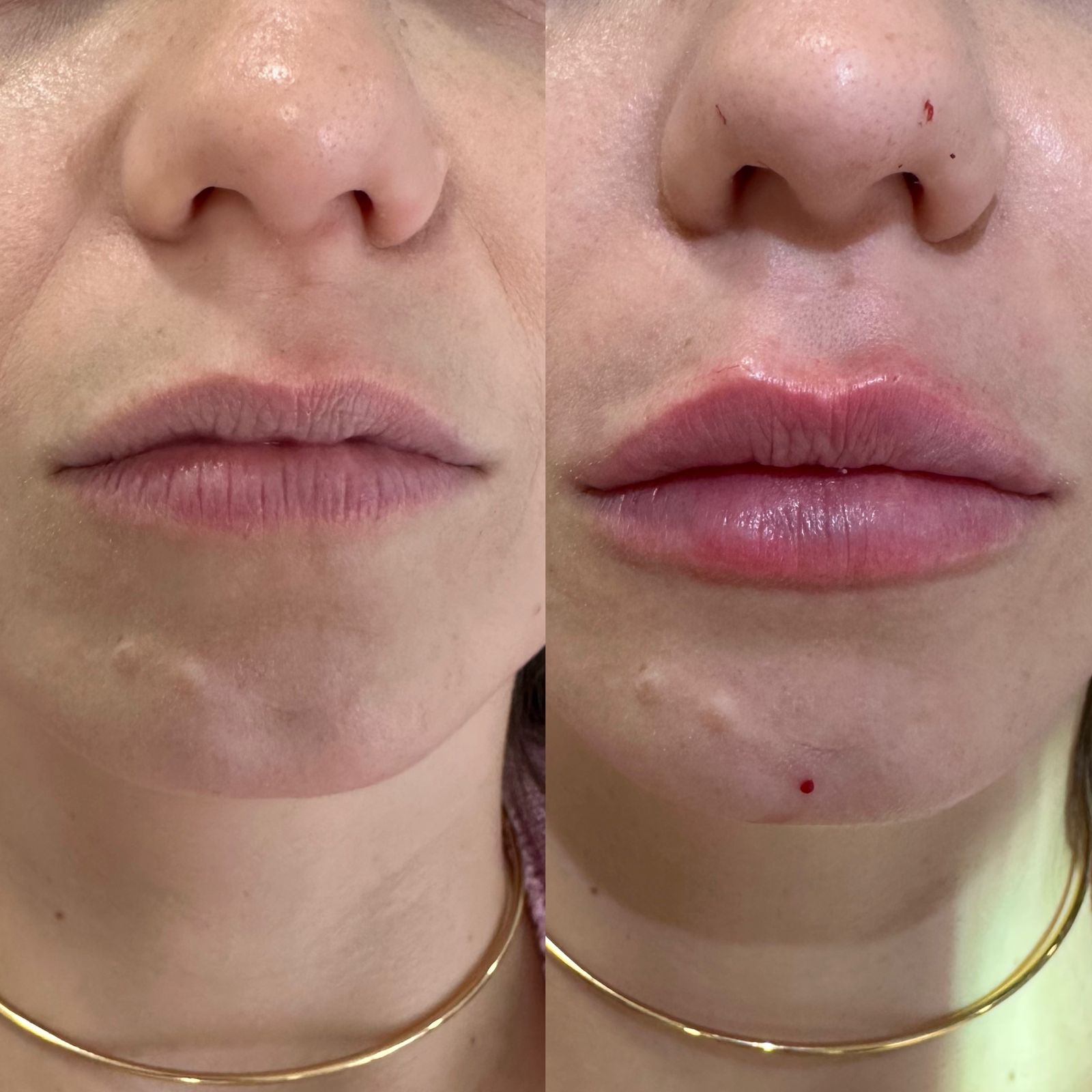 Imagem do WhatsApp de 2025-06-04 à(s) 22.03.57_b21f5267