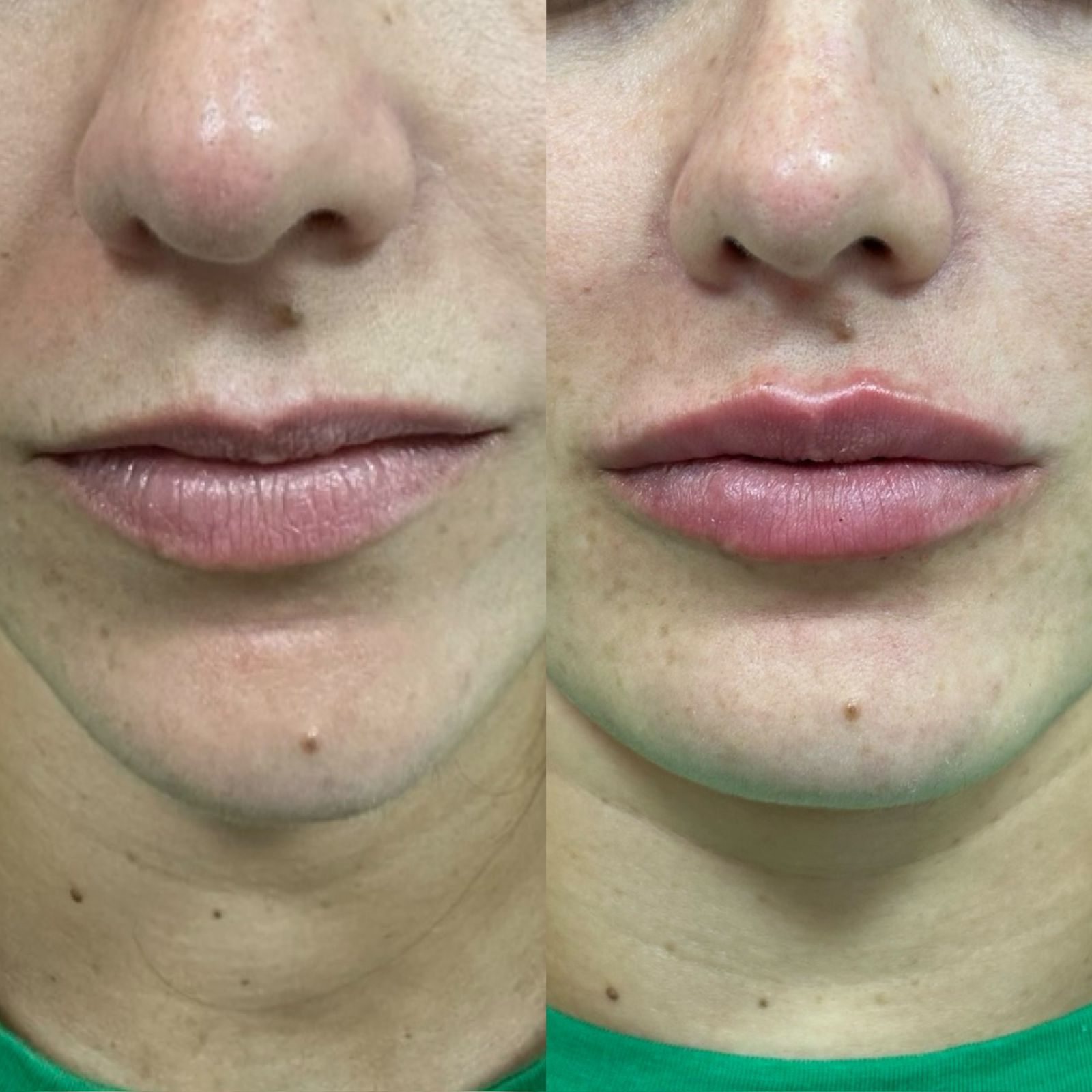 Imagem do WhatsApp de 2025-06-04 à(s) 22.04.06_a5a8c384